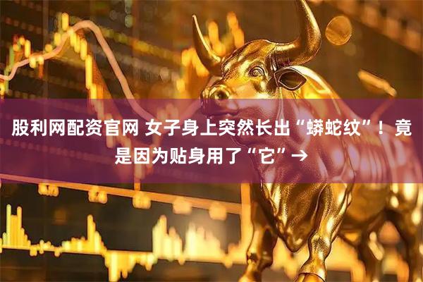 股利网配资官网 女子身上突然长出“蟒蛇纹”！竟是因为贴身用了“它”→